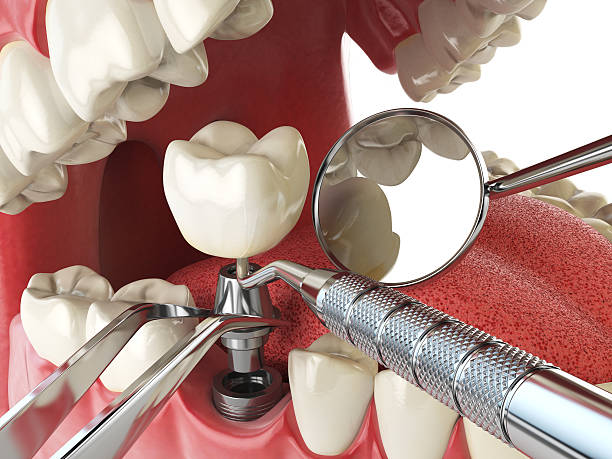 Best Emergency Cosmetic Dentistry (e.g., broken veneers) in East Franklin, NJ